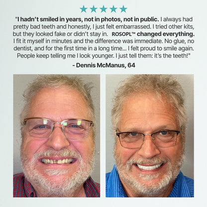 🦷ACHRITI™ Custom-Fit Full Functional Dentures Make you more confident