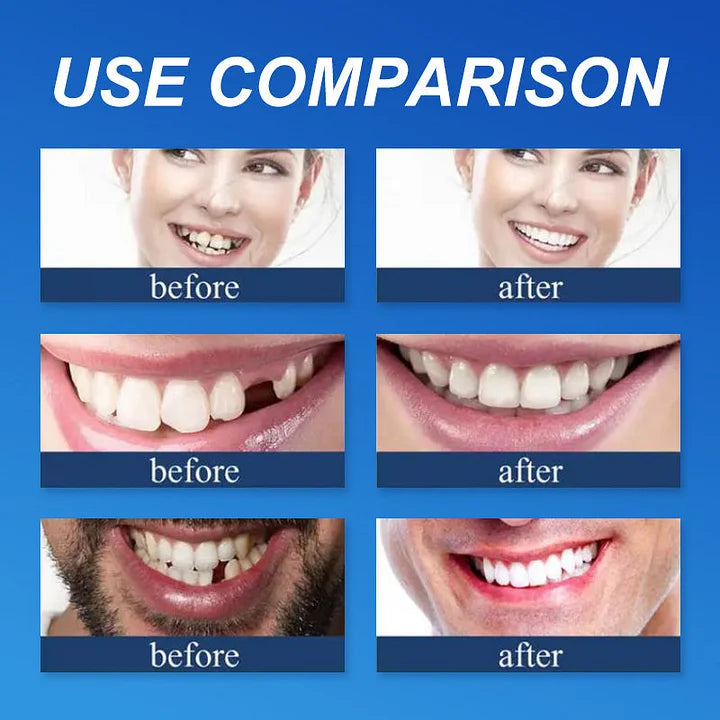 🦷 DarkFairy™ Medical Full Denture with Strong Suctiond Custom-Fit Full Functional Dentures