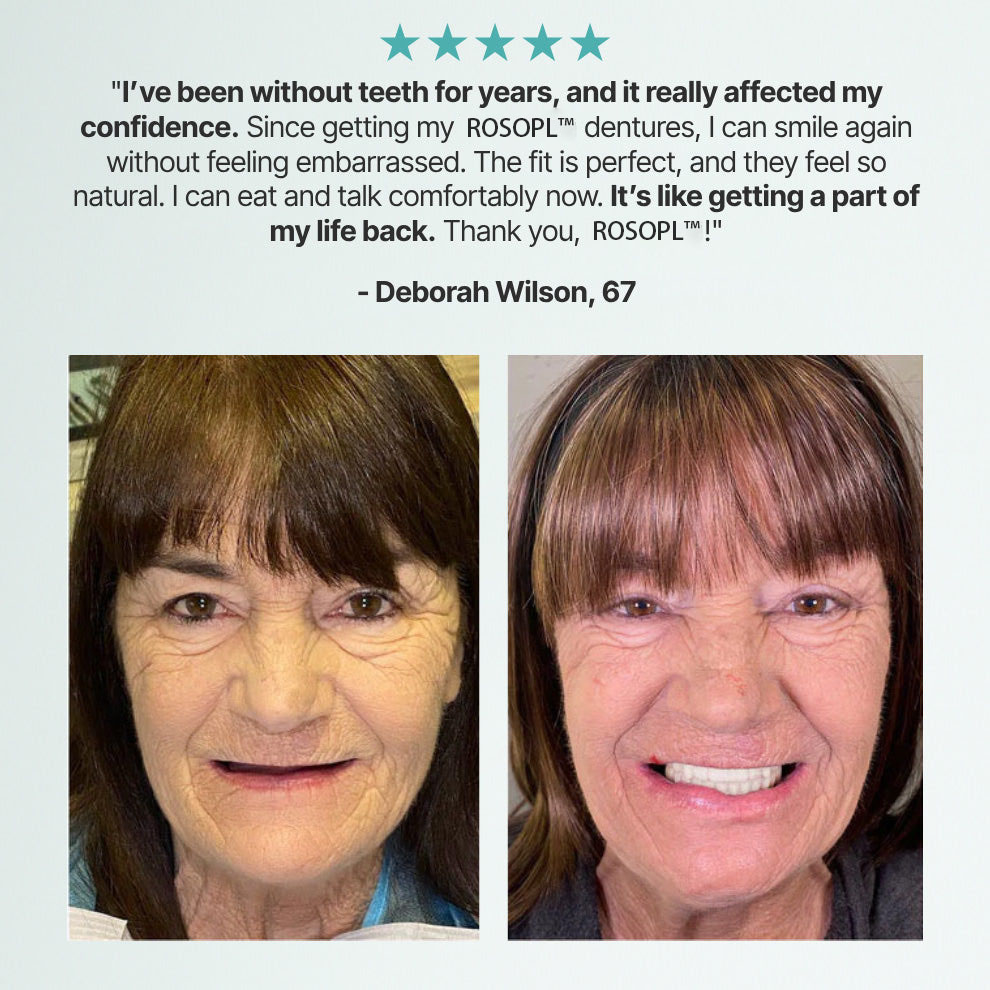 🦷ACHRITI™ Custom-Fit Full Functional Dentures Make you more confident