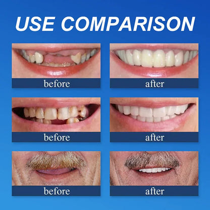 🦷 DarkFairy™ Medical Full Denture with Strong Suctiond Custom-Fit Full Functional Dentures